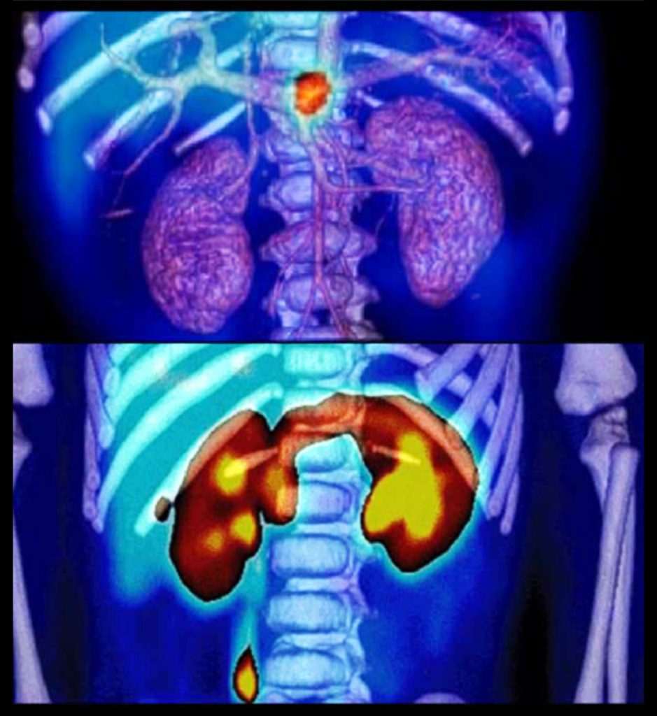 Resultado de imagen para medicina nuclear