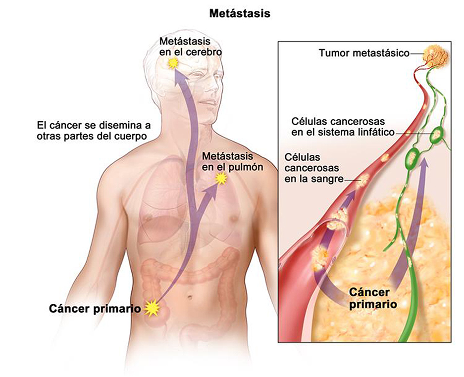 Lee más sobre el artículo Hablemos del Cáncer.